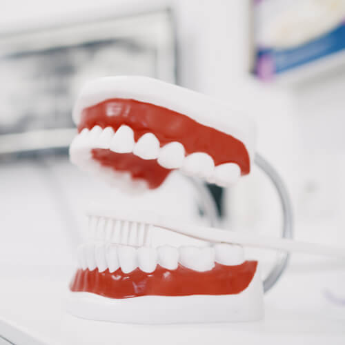 Die Zahnprophylaxe wird umgangssprachlich auch professionelle Zahnreinigung genannt.